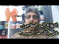انتفاخ اليد المفاجئ اعرف الأسباب امتى تقلق وايه العلاج د ماجد سامي