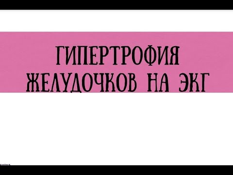 Расшифровка ЭКГ при гипертрофии желудочков - meduniver.com