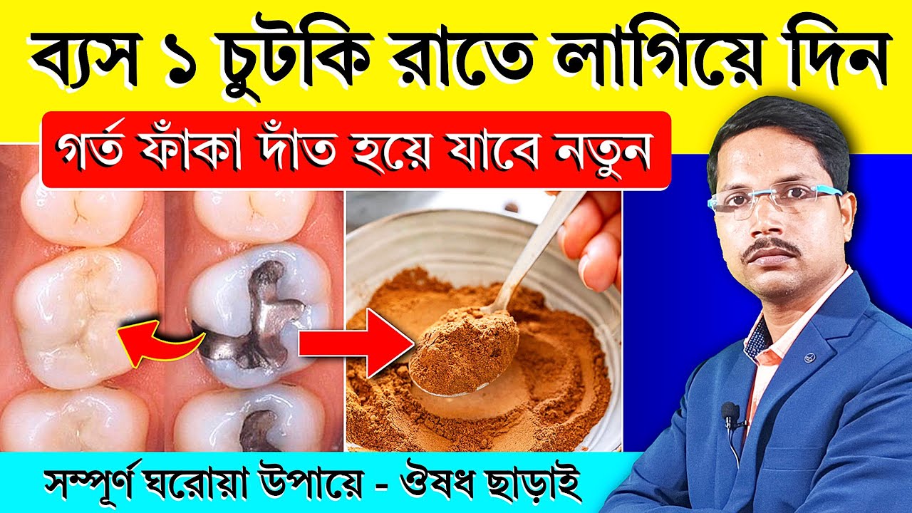 দাঁতের A To Z সমস্যার সমাধান | গর্ত, ফাঁকা, পোকা লাগা ও হলুদ দাঁত থেকে 100% মুক্তি | Dental Solution