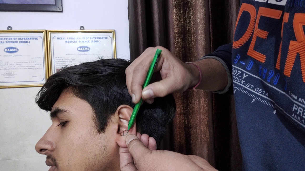 Training Auricular therapy Antitragus points 