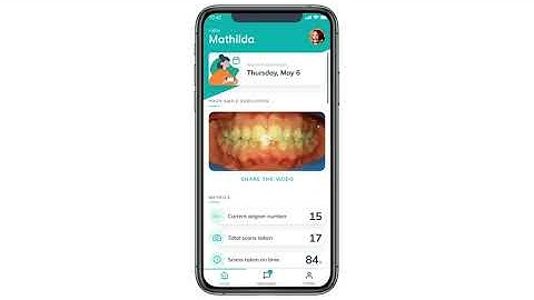 Intro to Dental Monitoring App