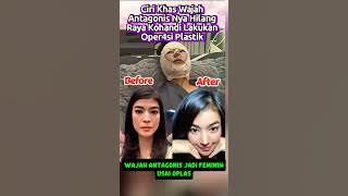 The antagonist RAYA KOHANDI's face changed into a protagonist after plastic surgery