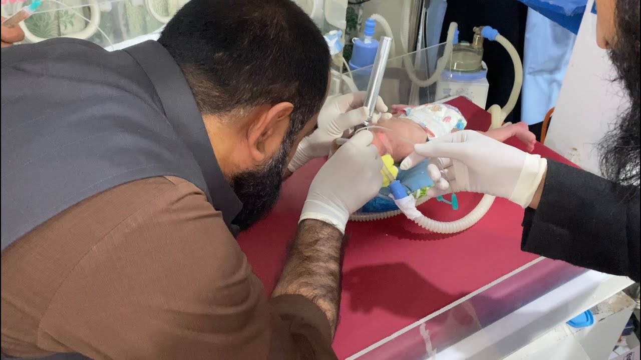 High-Risk Procedure in Preterm Babies | Surfactant Therapy Explained