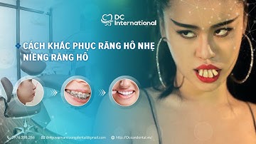 Cách Khắc Phục Răng Hô Nhẹ! Niềng Răng Hô Dr Cường