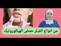 من انواع الفيلر حمض الهيالورونيك انواع تكبير الشفايف فيلر الشفايف الفرنسية 