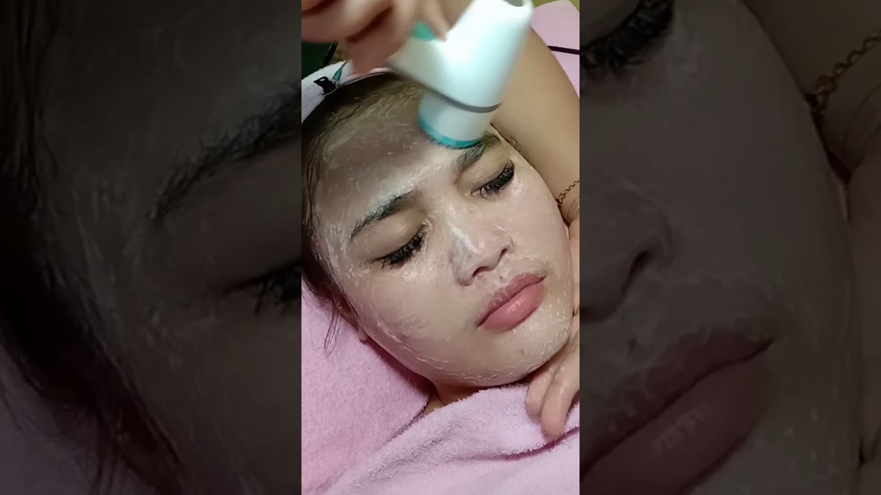 Cara ampuh hilangin jerawat dengan facial bekam dan laser ...