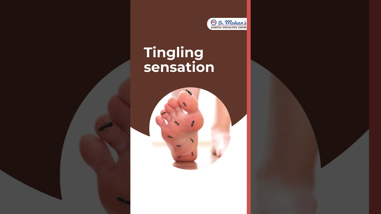 6 Signs Of High Blood Sugar You Can Spot On Your Feet | Diabetic Foot Treatment in Chennai