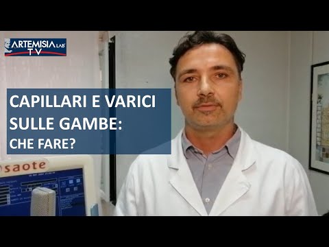 Video: Oli Essenziali Per Le Vene Varicose: Funzionano?