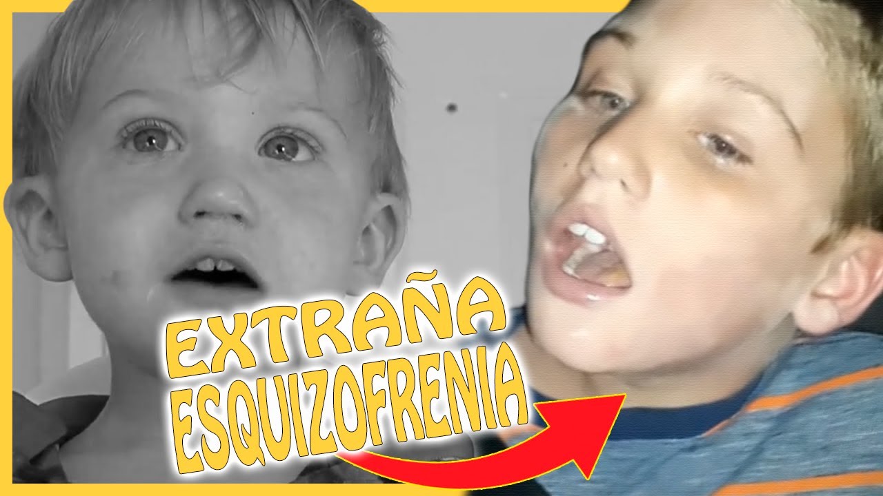 EXTRAÑA ESQUIZOFRENIA con AUTISMO / ¿QUÉ fue de BODHI SCHOFIELD YouTube