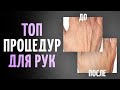 Эффективные процедуры для кожи рук
