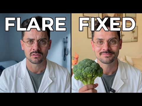 Prevent Diverticulitis Recurrence: 5 Things To Fix Before Your Next Flare thumbnail