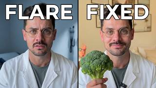 Prevent Diverticulitis Recurrence: 5 Things To Fix Before Your Next Flare