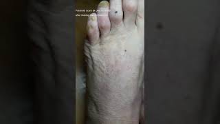 Korean paranoid police stab, act up by Mind Control Weapon 20260328