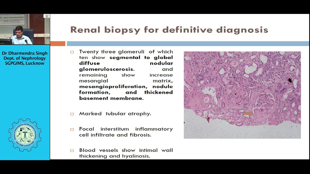 Specreum of kidney diseases, Dr Dharmandra, Nephrology