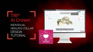 TRI® AI Individual Healing Collar Design Tutorial | matrix® System