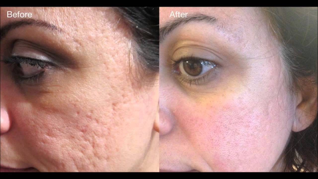 Nerium AD Age Defying Night Treatment 30ml   2 Bottles