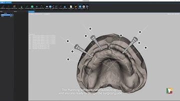 GuideDesign Tutorial - Prepare case in Planning Software