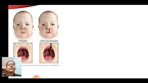 # Mitochondrial Disorder and Polygenic Disorders #Class 9