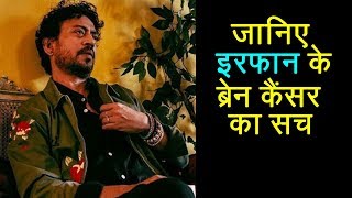 Is Irrfan Khan Having Brain Cancer ? जानें क्‍या सच में है उन्‍हें Brain Tumor