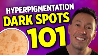 Improve dark spots on face! Here's What Actually Works