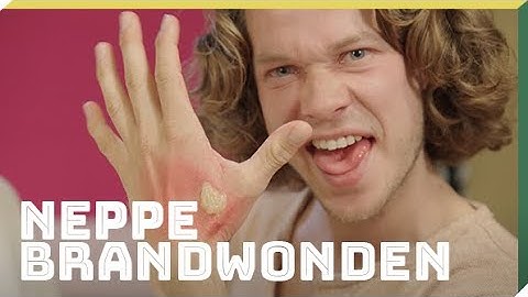 Maak je eigen nep-brandwond | Doe het zelf | Het Klokhuis