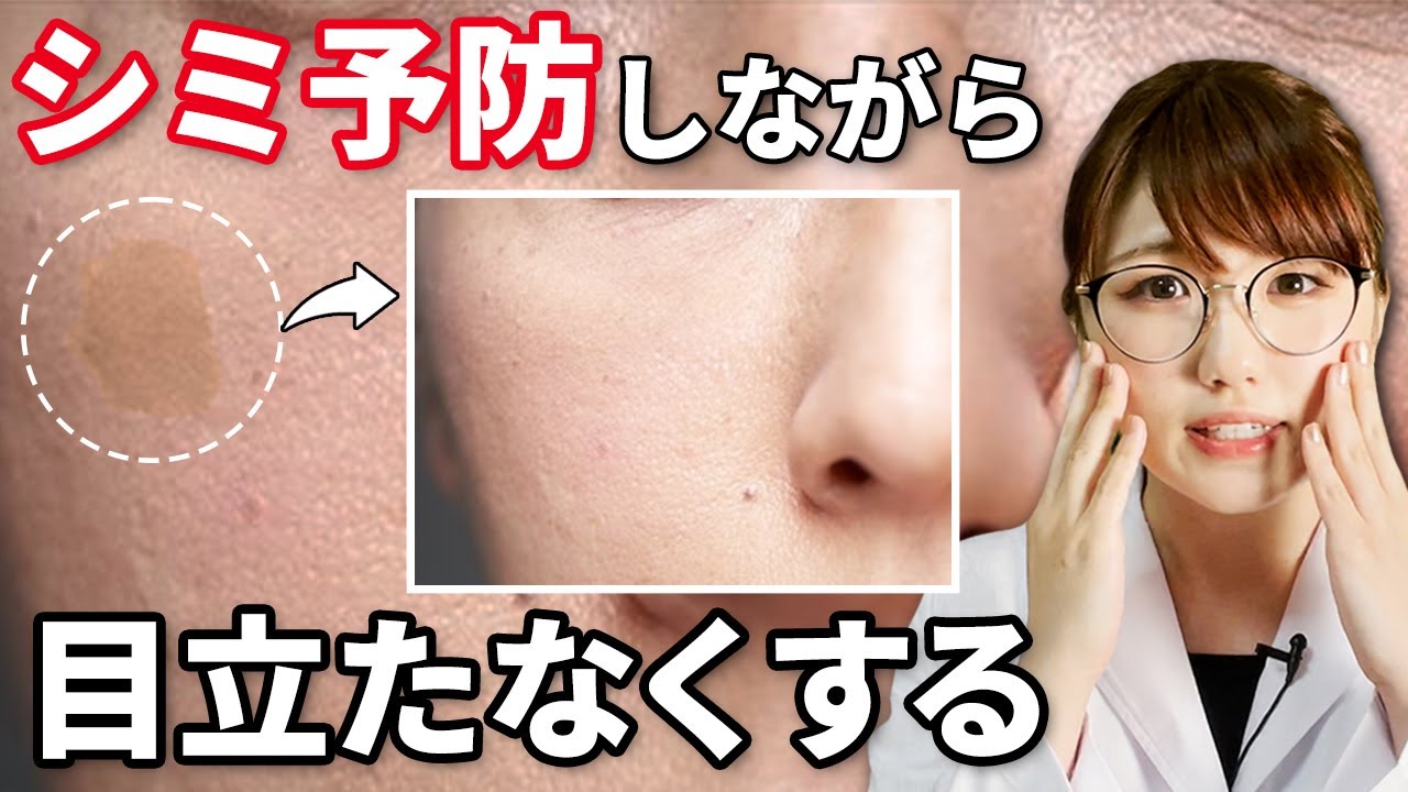 シミ対策 シミを予防しばがら目立たなくする方法３選 Youtube