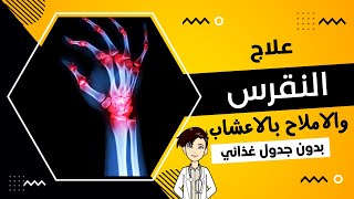 علاج النقرس