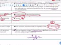 NCLEX Must-Know! Hypokalemia vs Hyperkalemia Made Easy,High-Yield Electrolyte CheatSheet#nursementor