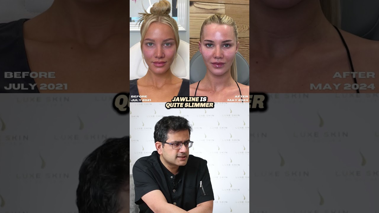 🤔 Love Island star: Grace Jackson’s 2021 vs. 2024 Look—Which Do You Prefer?