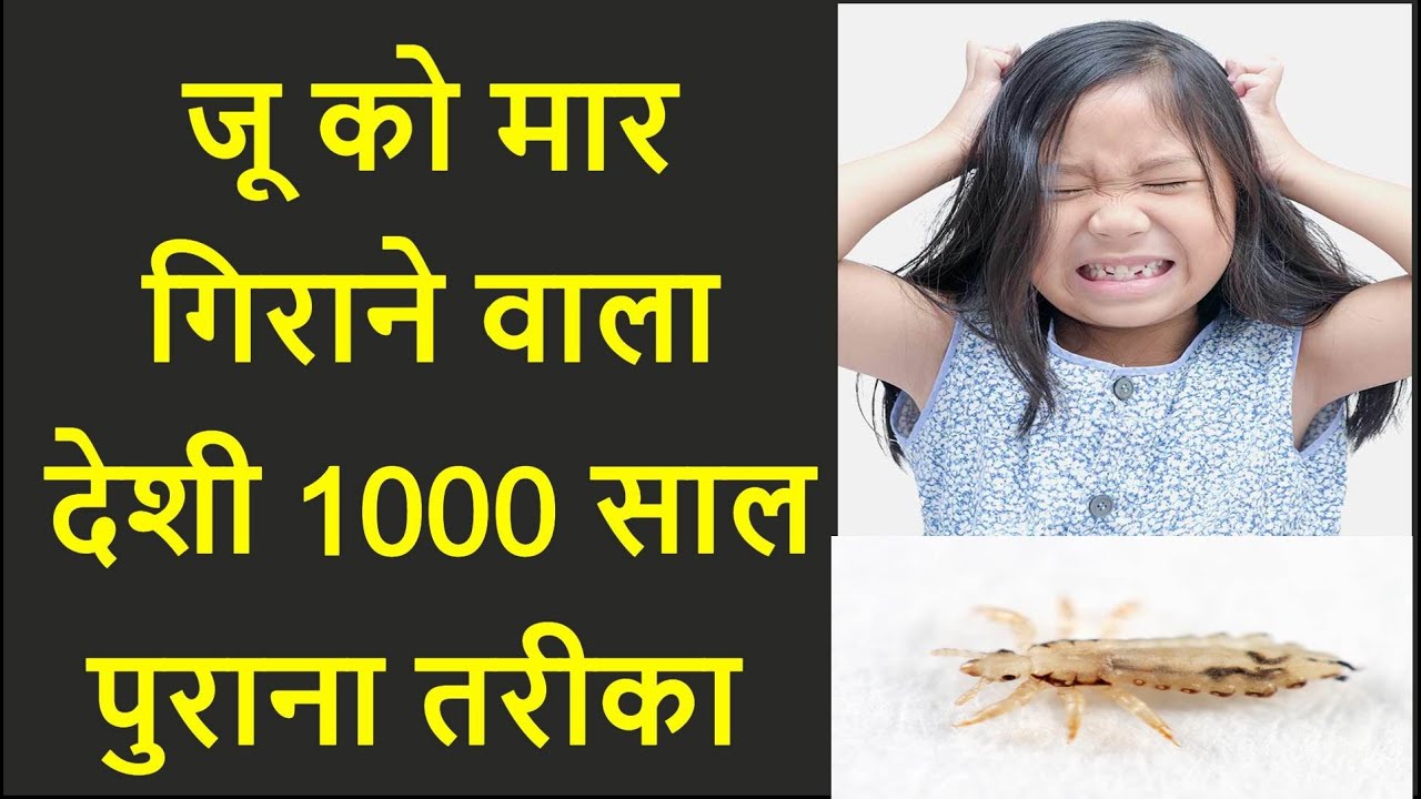 1 मिनट में सर की जुए खत्म ! head lice treatment in hindi ! YouTube
