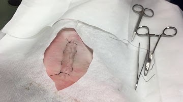 The Running Horizontal Mattress Suture