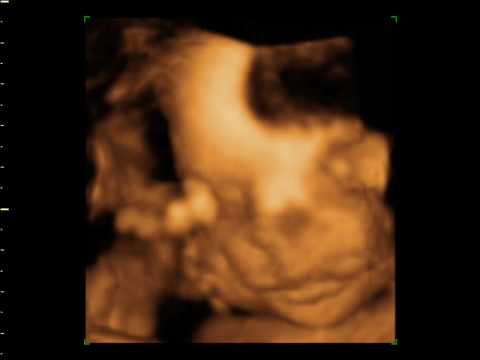 ultrasound near me Jackie and Jon