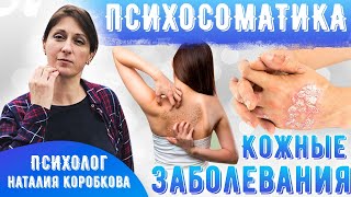 Кожные заболевания_психосоматика: атопический дерматит, псориаз, экзема, нейродермит.