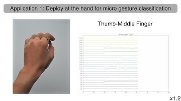BandEI: A Flexible Electrical Impedance Sensing Bandage for Deep Muscles and Tendons