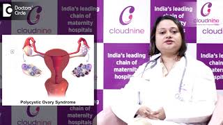 What is lean PCOS? | Cloudnine Hospitals