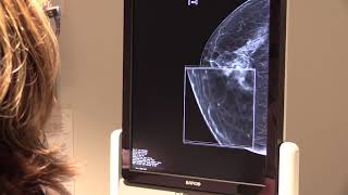 Breast Cancer Awareness Month October 2018