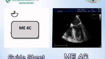 085 Guide Sheet for Basic TEE examination KAMC