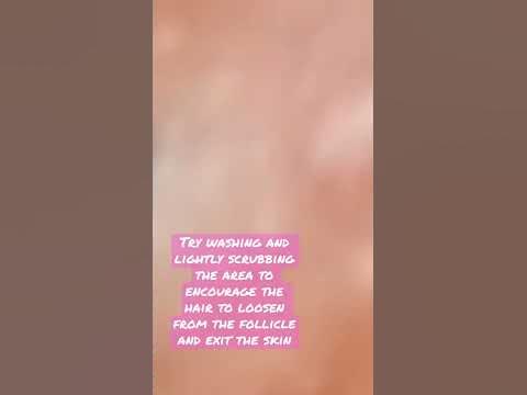 Stop Ingrown Hairs On Private Areas #shorts skincaretips #acnetreatment