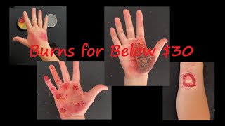 Burns for Below $30 (Basics of Budget Moulage Ep. 4)