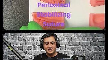 Periosteal Stabilizing Suture over a Membrane