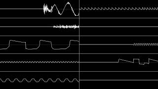 Nighthawk (Martin Freij) - Trams (Oscilloscope View) (XM)