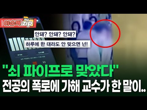 ＂쇠 파이프로 맞았다＂ <strong>대학병원</strong> 전공의 폭로에 가해 교수가 한 말이.. | 이슈픽 zip