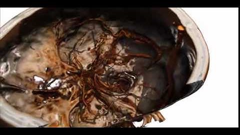 Animation created from a head CT by using ORS Visual Pro