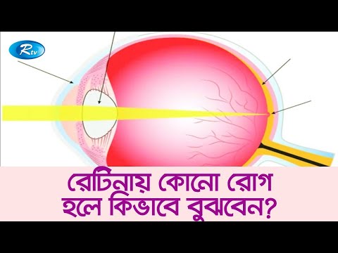 ভিডিও: ম্যাকুলা ইউট্রিকুলির কাজ কী?