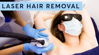 All about Laser Hair Removal