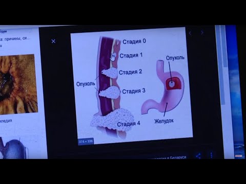 Язва или рак? / Здравствуйте