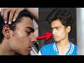 Best Routine for Oily Acne Prone Sensitive Skin (No BS)
