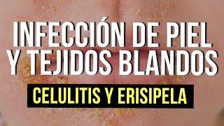 Infección de piel y tejidos blandos 🦠 | Celulitis y Erisipela