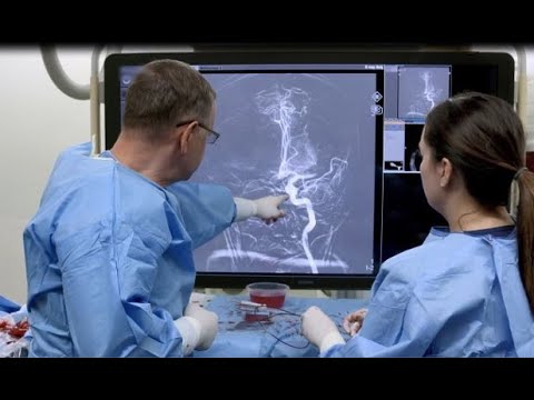 Wideo: Trombektomia - Rodzaje Operacji, Wskazania, Wyniki