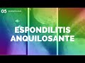 ESPONDILITIS ANQUILOSANTE - ENARM
